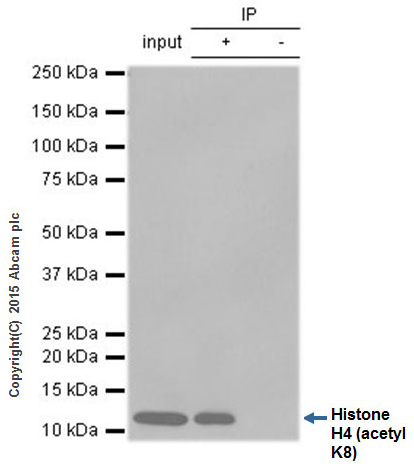 Immunoprecipitation - Rabbit IgG, monoclonal [EPR25A] - Isotype Control (ab172730), expandable thumbnail