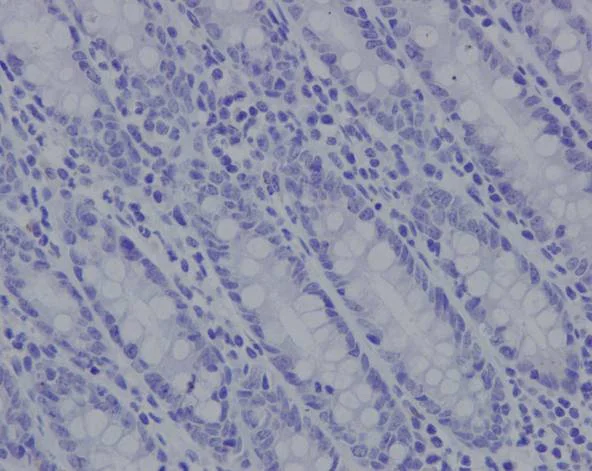 Immunohistochemistry (Formalin/PFA-fixed paraffin-embedded sections) - Rabbit IgG, monoclonal [EPR25A] - Isotype Control - BSA and Azide Free (AB210849)