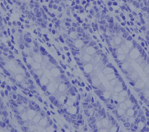 Immunohistochemistry (Formalin/PFA-fixed paraffin-embedded sections) - Rabbit IgG, monoclonal [EPR25A] - Isotype Control - BSA and Azide Free (AB210849)