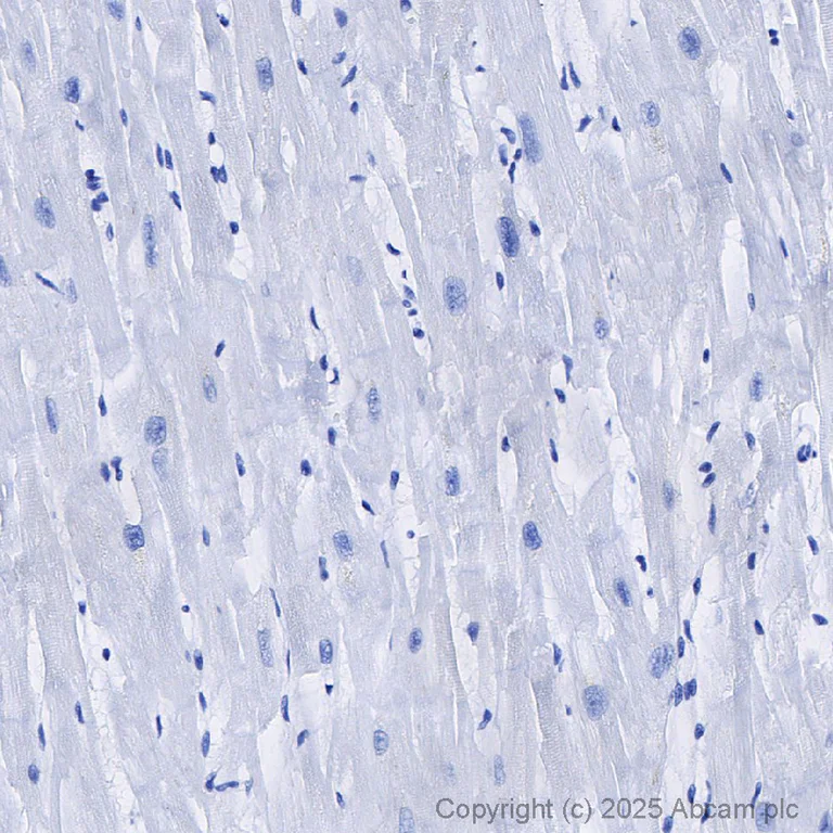 Immunohistochemistry (Formalin/PFA-fixed paraffin-embedded sections) - Rabbit IgG, monoclonal [EPR25A] - Isotype Control - BSA and Azide Free (AB210849)