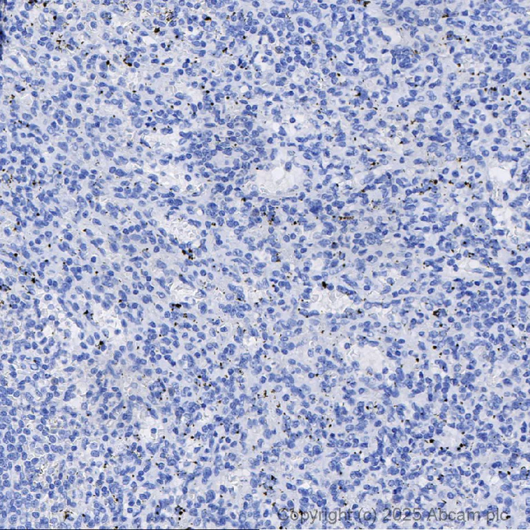 Immunohistochemistry (Formalin/PFA-fixed paraffin-embedded sections) - Rabbit IgG, monoclonal [EPR25A] - Isotype Control - BSA and Azide Free (AB210849)