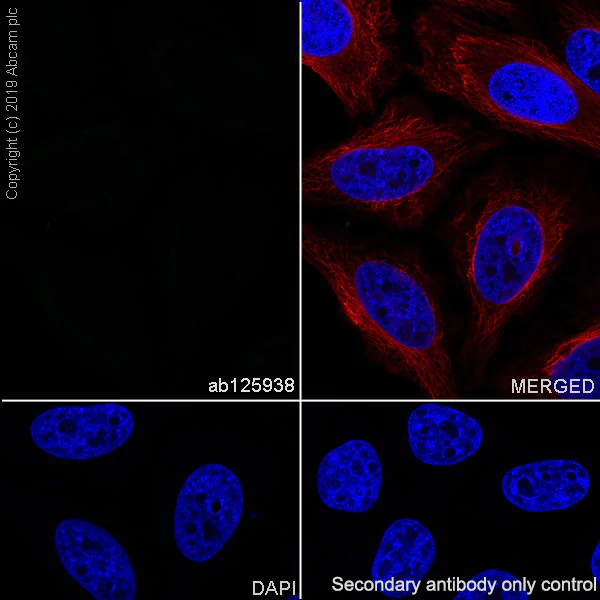 Immunocytochemistry/ Immunofluorescence - Rabbit IgG, monoclonal [SP137] - isotype control (BSA and Azide free) (AB208334)