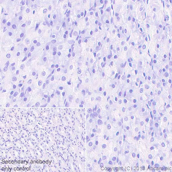 Immunohistochemistry (Formalin/PFA-fixed paraffin-embedded sections) - Rabbit IgG, monoclonal [SP137] - isotype control (BSA and Azide free) (AB208334)