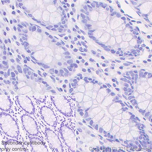Immunohistochemistry (Formalin/PFA-fixed paraffin-embedded sections) - Rabbit IgG, monoclonal [SP137] - isotype control (BSA and Azide free) (AB208334)