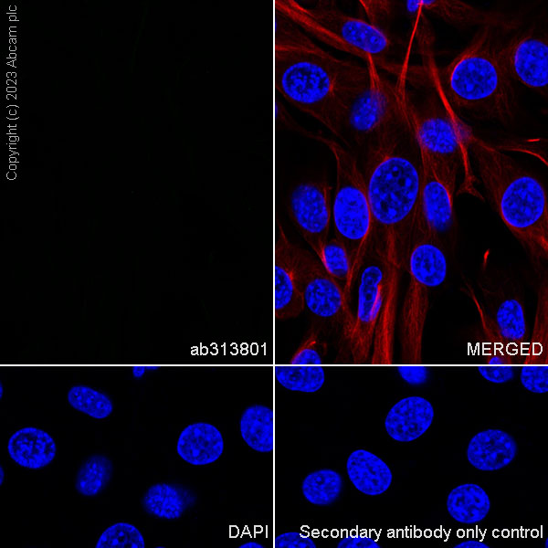 Immunocytochemistry/ Immunofluorescence - Rabbit IgG, multiclonal [RM1060] - Isotype control (ab313801), expandable thumbnail