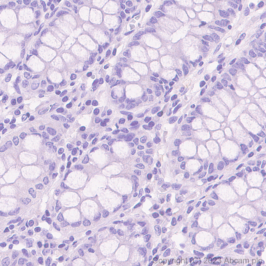 Immunohistochemistry (Formalin/PFA-fixed paraffin-embedded sections) - Rabbit IgG, multiclonal [RM1060] - Isotype control (ab313801), expandable thumbnail