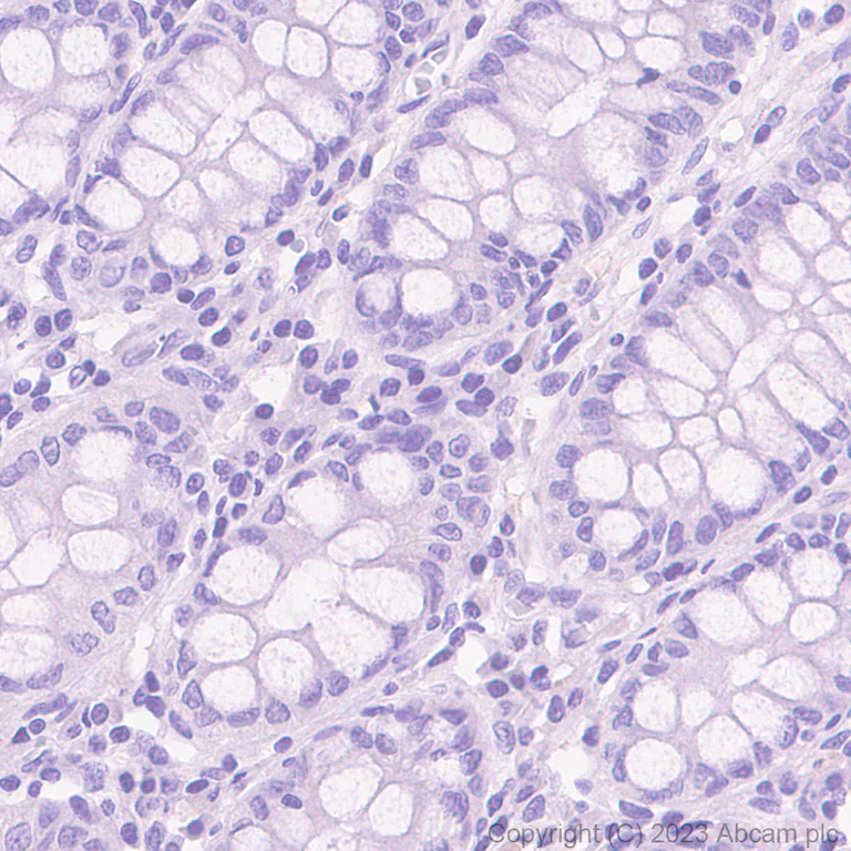 Immunohistochemistry (Formalin/PFA-fixed paraffin-embedded sections) - Rabbit IgG, multiclonal [RM1060] - Isotype control (AB313801)