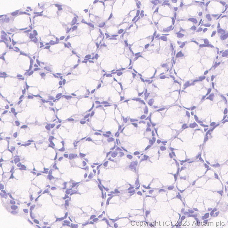 Immunohistochemistry (Formalin/PFA-fixed paraffin-embedded sections) - Rabbit IgG, multiclonal [RM1060] - Isotype control (AB313801)