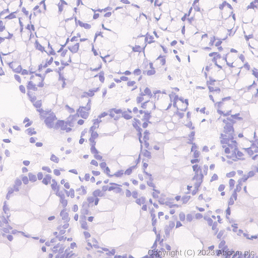 Immunohistochemistry (Formalin/PFA-fixed paraffin-embedded sections) - Rabbit IgG, multiclonal [RM1060] - Isotype control (ab313801), expandable thumbnail