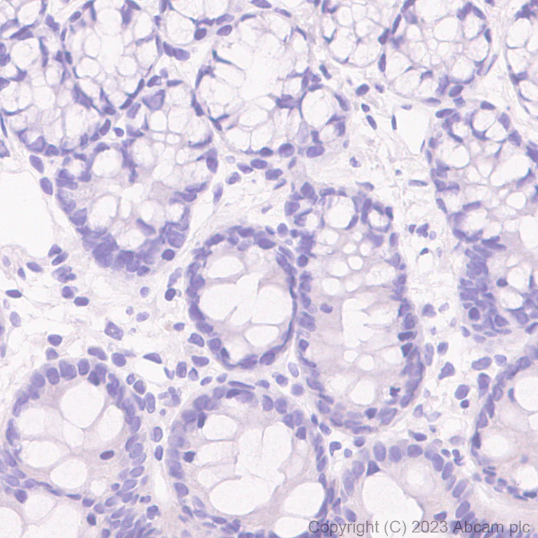 Immunohistochemistry (Formalin/PFA-fixed paraffin-embedded sections) - Rabbit IgG, multiclonal [RM1060] - Isotype control (AB313801)