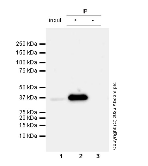 Immunoprecipitation - Rabbit IgG, multiclonal [RM1060] - Isotype control (ab313801), expandable thumbnail
