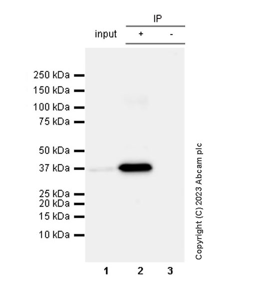 Immunoprecipitation - Rabbit IgG, multiclonal [RM1060] - Isotype control (ab313801), expandable thumbnail