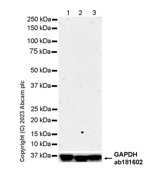 Western blot - Rabbit IgG, multiclonal [RM1060] - Isotype control (AB313801)