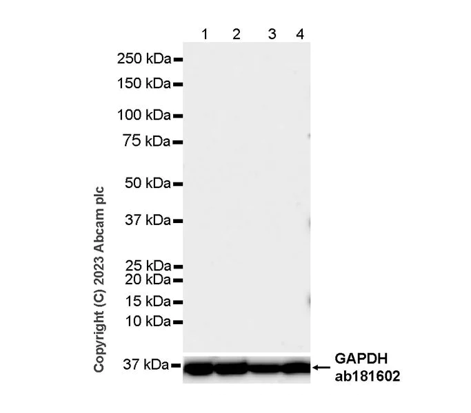 Western blot - Rabbit IgG, multiclonal [RM1060] - Isotype control - BSA and Azide free (AB313802)