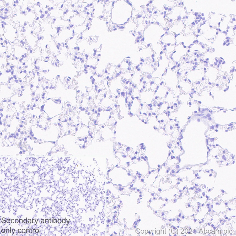 Immunohistochemistry (Formalin/PFA-fixed paraffin-embedded sections) - Rabbit monoclonal [EPR24334-118] to SARS-CoV-2 nucleocapsid protein (ab271180), expandable thumbnail