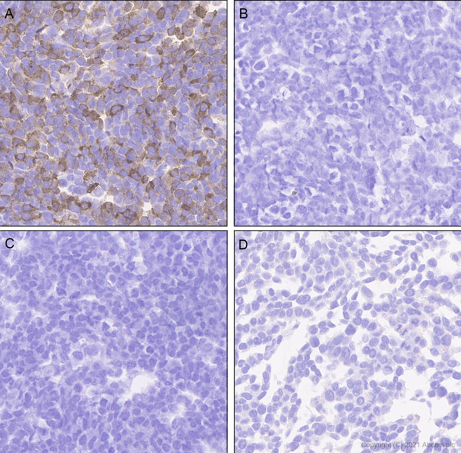 Immunohistochemistry (Formalin/PFA-fixed paraffin-embedded sections) - Rabbit monoclonal [EPR24334-118] to SARS-CoV-2 nucleocapsid protein (ab271180), expandable thumbnail