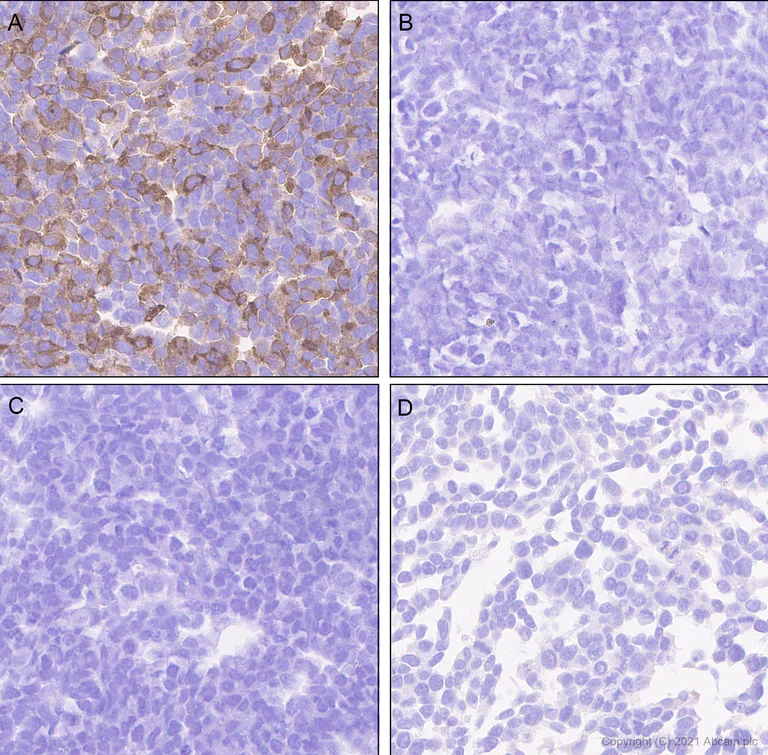 Immunohistochemistry (Formalin/PFA-fixed paraffin-embedded sections) - Rabbit monoclonal [EPR24334-118] to SARS-CoV-2 nucleocapsid protein (AB271180)