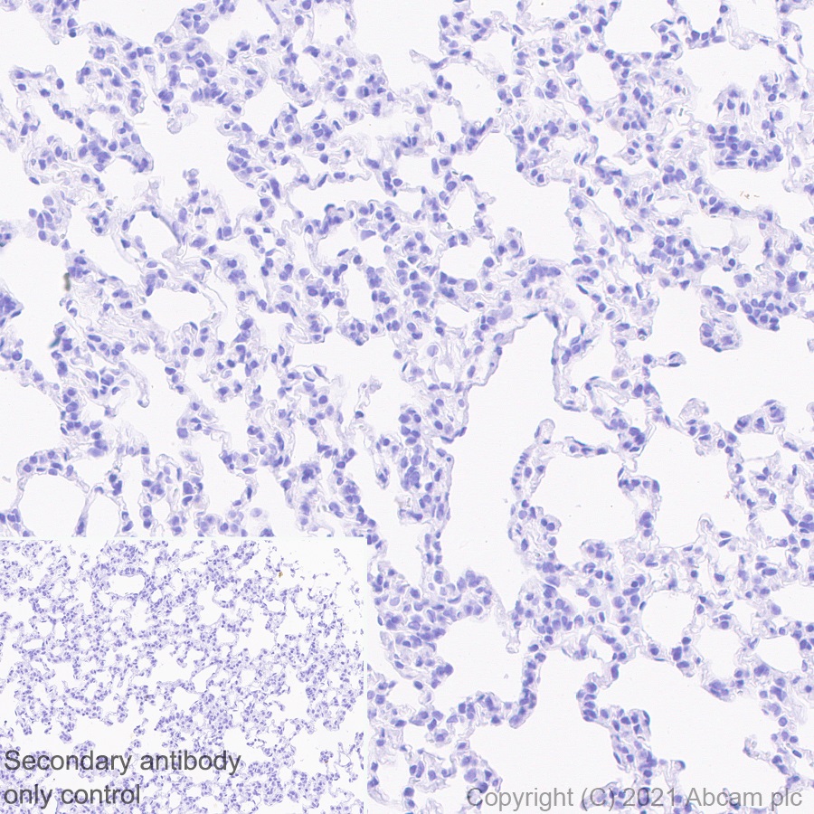 Immunohistochemistry (Formalin/PFA-fixed paraffin-embedded sections) - Rabbit monoclonal [EPR24334-118] to SARS-CoV-2 nucleocapsid protein (ab271180), expandable thumbnail