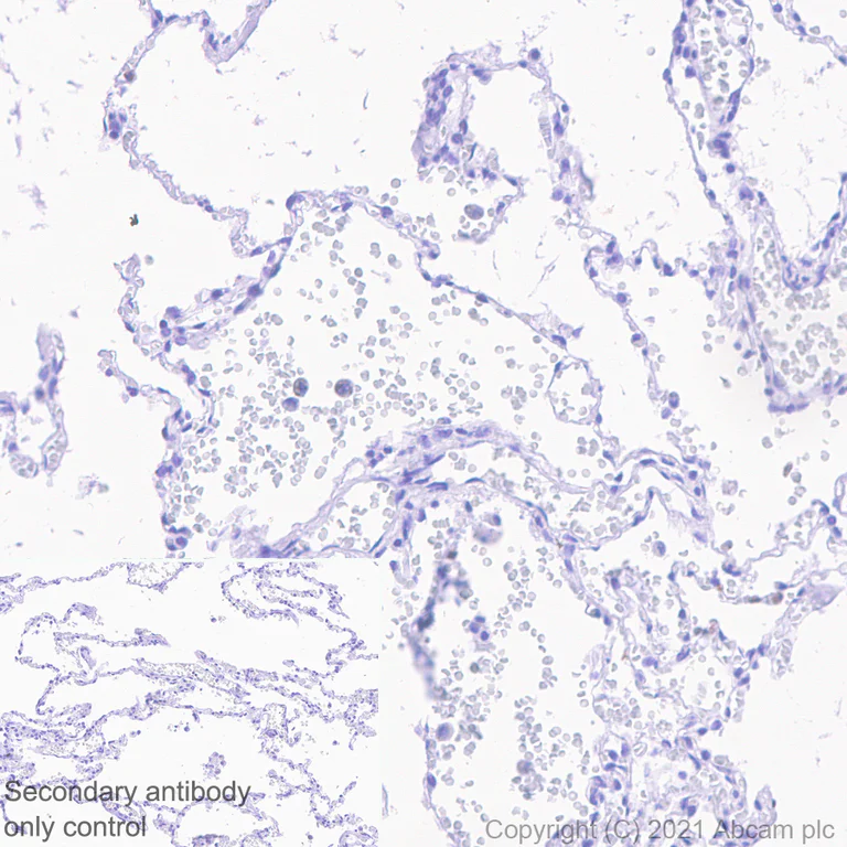Immunohistochemistry (Formalin/PFA-fixed paraffin-embedded sections) - Rabbit monoclonal [EPR24334-118] to SARS-CoV-2 nucleocapsid protein (AB271180)