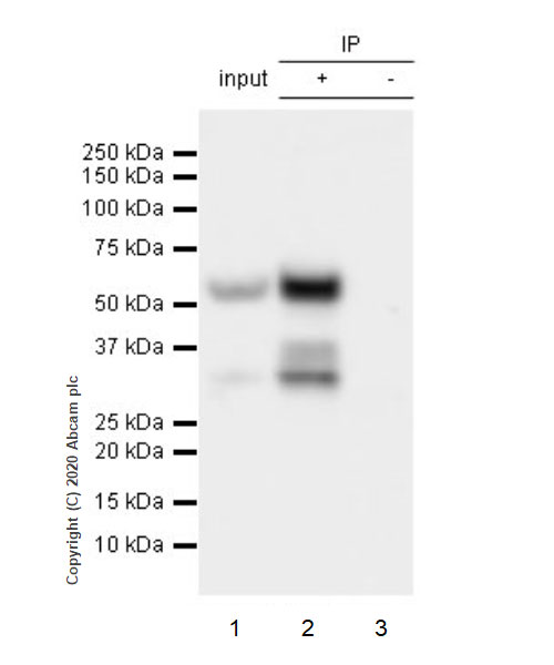 Immunoprecipitation - Rabbit monoclonal [EPR24334-118] to SARS-CoV-2 nucleocapsid protein (ab271180), expandable thumbnail