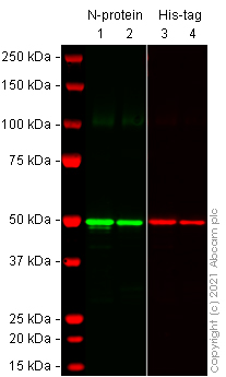 Western blot - Rabbit monoclonal [EPR24334-118] to SARS-CoV-2 nucleocapsid protein (AB271180), expandable thumbnail