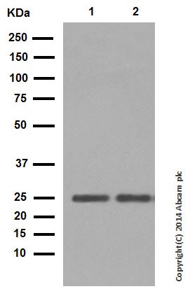 Western blot - Rabbit monoclonal [H19-5] Anti-Human kappa light chain (AB125919), expandable thumbnail