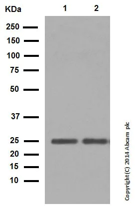 Western blot - Rabbit monoclonal [H19-5] Anti-Human kappa light chain (AB125919)
