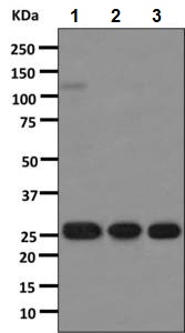 Western blot - Rabbit monoclonal [H19-5] Anti-Human kappa light chain (AB125919), expandable thumbnail