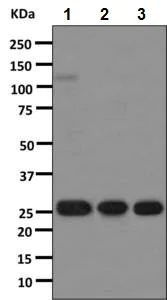 Western blot - Rabbit monoclonal [H19-5] Anti-Human kappa light chain (AB125919)