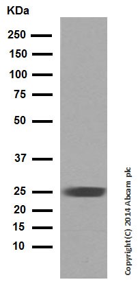 Western blot - Rabbit monoclonal [H19-5] Anti-Human kappa light chain (AB125919), expandable thumbnail