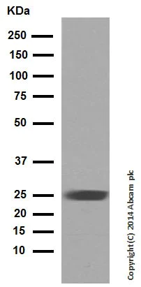 Western blot - Rabbit monoclonal [H19-5] Anti-Human kappa light chain (AB125919)