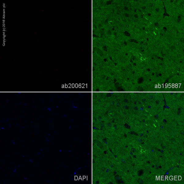 Immunohistochemistry (Formalin/PFA-fixed paraffin-embedded sections) - Rabbit monoclonal [H19-5] Anti-Human kappa light chain (Alexa Fluor® 647) (AB200621)