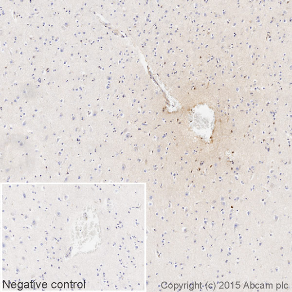 Immunohistochemistry (Formalin/PFA-fixed paraffin-embedded sections) - Rabbit monoclonal [H19-5] Anti-Human kappa light chain (Biotin) (AB201484), expandable thumbnail