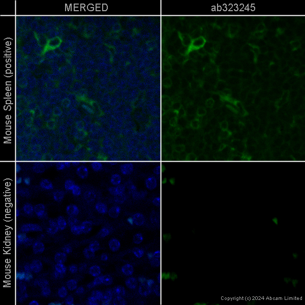 Immunohistochemistry (Formalin/PFA-fixed paraffin-embedded sections) - Rabbit monoclonal [H26-10] Anti-Human IgG1 H&L (Alexa Fluor® 488) (AB200622)