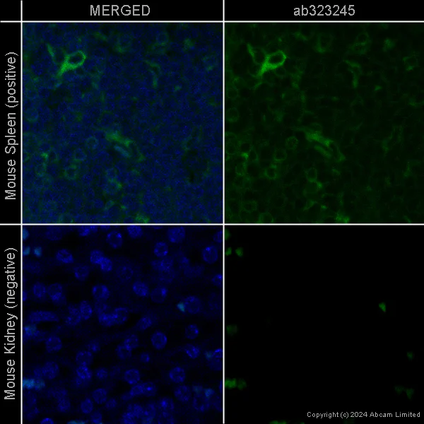 Immunohistochemistry (Formalin/PFA-fixed paraffin-embedded sections) - Rabbit monoclonal [H26-10] Anti-Human IgG1 H&L (Alexa Fluor® 488) (AB200622)