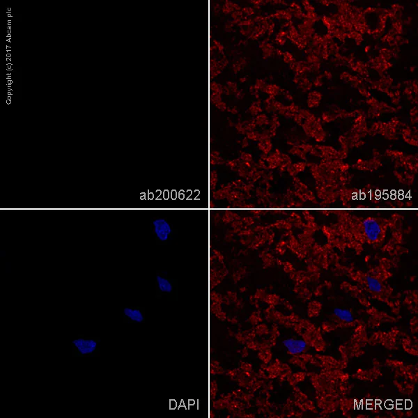 Immunohistochemistry (Frozen sections) - Rabbit monoclonal [H26-10] Anti-Human IgG1 H&L (Alexa Fluor® 488) (AB200622)