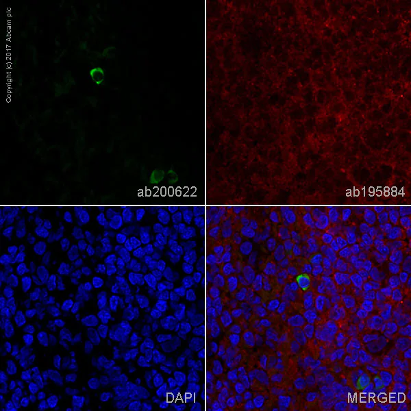 Immunohistochemistry (Frozen sections) - Rabbit monoclonal [H26-10] Anti-Human IgG1 H&L (Alexa Fluor® 488) (AB200622)