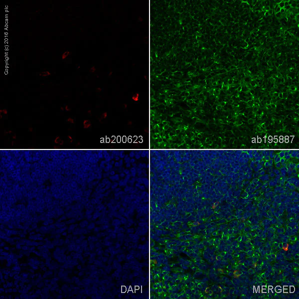 Immunohistochemistry (Formalin/PFA-fixed paraffin-embedded sections) - Rabbit monoclonal [H26-10] Anti-Human IgG1 H&L (Alexa Fluor® 647) (AB200623)