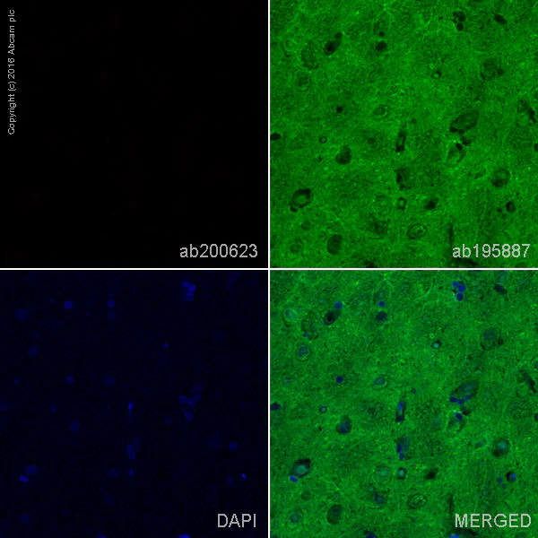 Immunohistochemistry (Formalin/PFA-fixed paraffin-embedded sections) - Rabbit monoclonal [H26-10] Anti-Human IgG1 H&L (Alexa Fluor® 647) (AB200623)