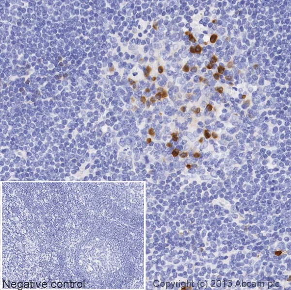 Immunohistochemistry (Formalin/PFA-fixed paraffin-embedded sections) - Rabbit monoclonal [H26-10] Anti-Human IgG1 H&L (Biotin) (AB201485)