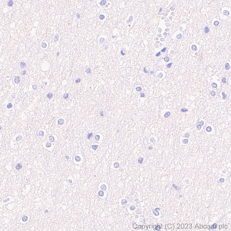 Immunohistochemistry (Formalin/PFA-fixed paraffin-embedded sections) - Rabbit monoclonal [M1gG51-4] Anti-Mouse IgG1 H&L (ab125913), expandable thumbnail