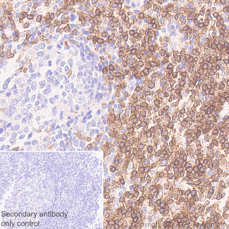 Immunohistochemistry (Formalin/PFA-fixed paraffin-embedded sections) - Rabbit monoclonal [M1gG51-4] Anti-Mouse IgG1 H&L (AB125913)