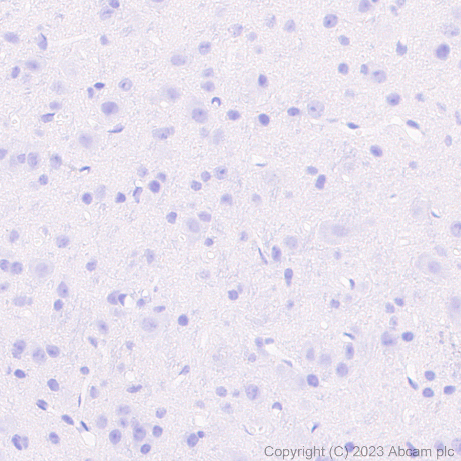 Immunohistochemistry (Formalin/PFA-fixed paraffin-embedded sections) - Rabbit monoclonal [M1gG51-4] Anti-Mouse IgG1 H&L (ab125913), expandable thumbnail