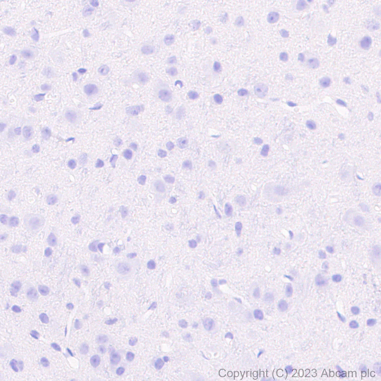 Immunohistochemistry (Formalin/PFA-fixed paraffin-embedded sections) - Rabbit monoclonal [M1gG51-4] Anti-Mouse IgG1 H&L (AB125913)