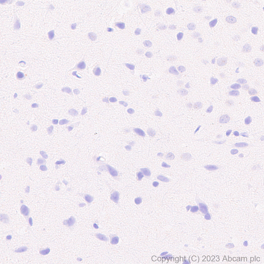 Immunohistochemistry (Formalin/PFA-fixed paraffin-embedded sections) - Rabbit monoclonal [M1gG51-4] Anti-Mouse IgG1 H&L (ab125913), expandable thumbnail