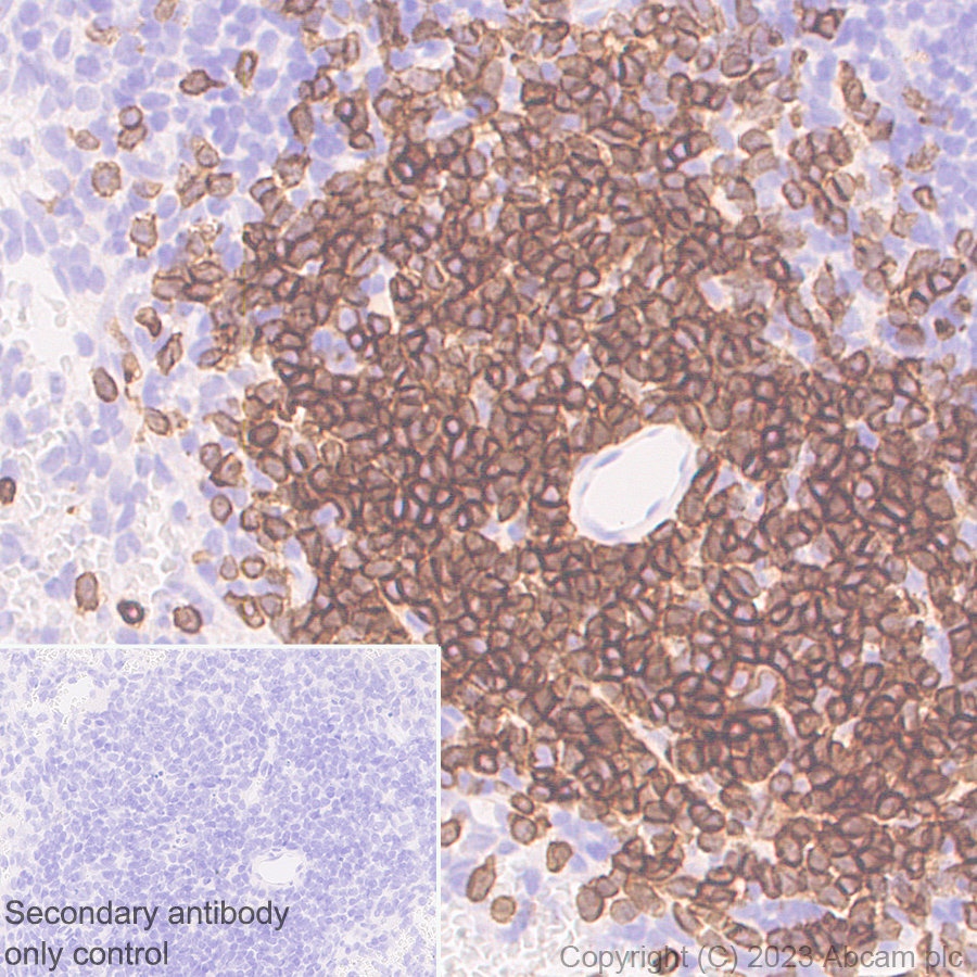 Immunohistochemistry (Formalin/PFA-fixed paraffin-embedded sections) - Rabbit monoclonal [M1gG51-4] Anti-Mouse IgG1 H&L (ab125913), expandable thumbnail