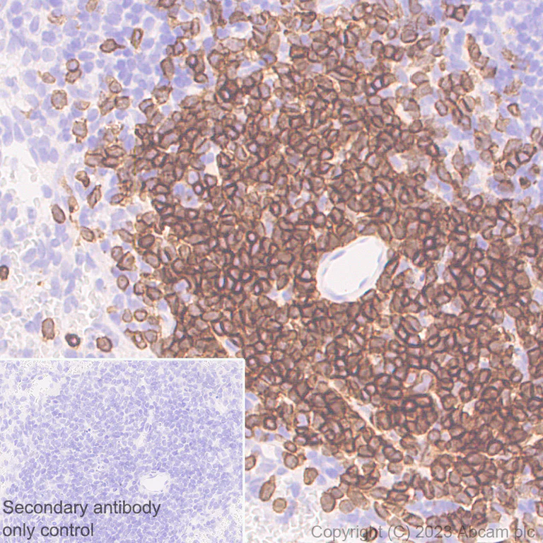 Immunohistochemistry (Formalin/PFA-fixed paraffin-embedded sections) - Rabbit monoclonal [M1gG51-4] Anti-Mouse IgG1 H&L (AB125913)