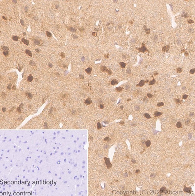 Immunohistochemistry (Formalin/PFA-fixed paraffin-embedded sections) - Rabbit monoclonal [M1gG51-4] Anti-Mouse IgG1 H&L (ab125913), expandable thumbnail