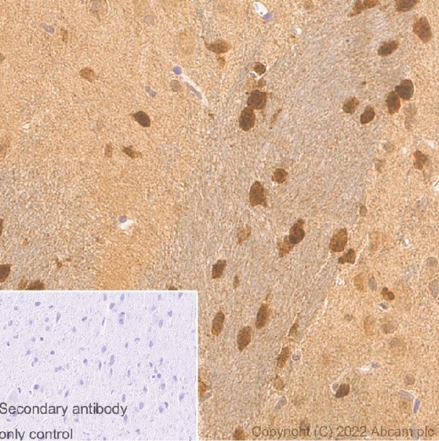 Immunohistochemistry (Formalin/PFA-fixed paraffin-embedded sections) - Rabbit monoclonal [M1gG51-4] Anti-Mouse IgG1 H&L (ab125913), expandable thumbnail