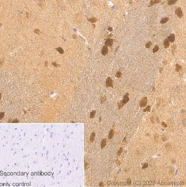 Immunohistochemistry (Formalin/PFA-fixed paraffin-embedded sections) - Rabbit monoclonal [M1gG51-4] Anti-Mouse IgG1 H&L (AB125913)